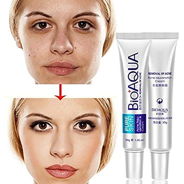 Bioaqua Anti Acne Scar Mark Removal Treatment Cream