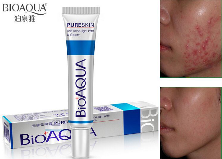 Bioaqua Anti Acne Scar Mark Removal Treatment Cream